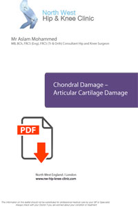 Chondral injry cartilage injuries treatments